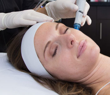 HYDRAFACIAL REJUVENATION  SILBER